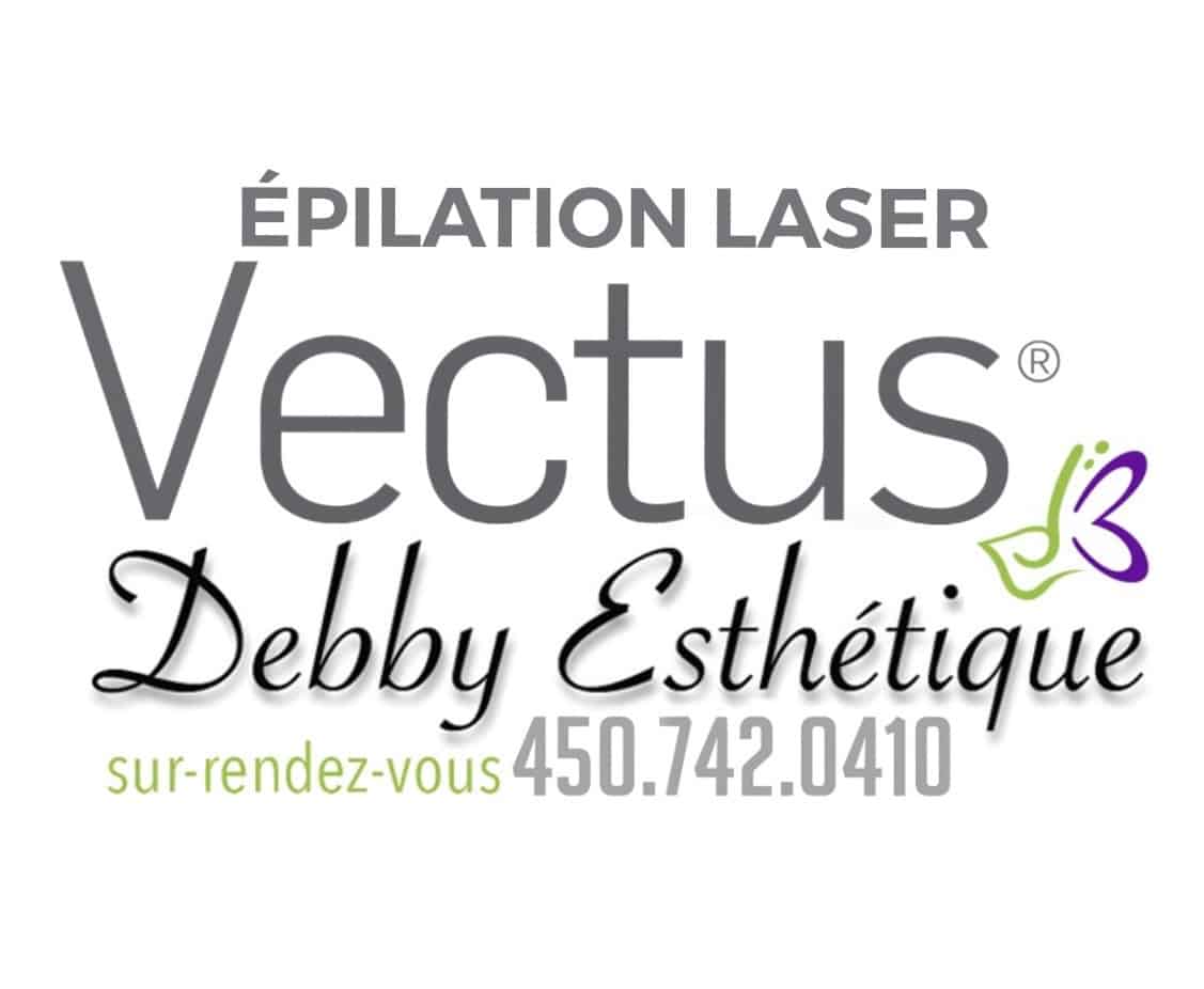 épilation laser vectus sorel tracy